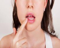 Как быстро вылечить стоматит во рту в домашних условиях